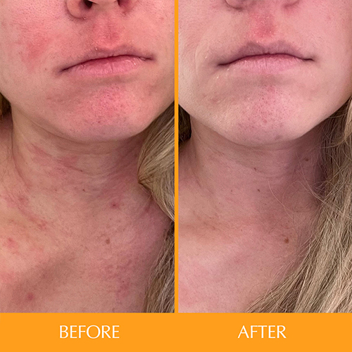 d8a7d8b3daa9d8a7db8cd986 d8aad8a7d985db8cd986 d987db8cd8b1d8aad8a7d985db8cd986 hairtamin skintamin 65a860bebbd30